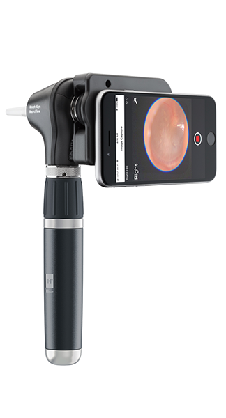 Image OTOSCOPE MACROVIEW PLUS DEL 3.5V POUR IEXAMINER